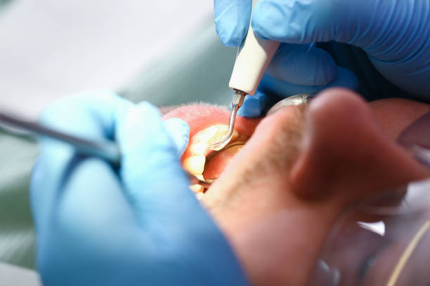 Best Emergency Dental Services for Seniors in Lafayette, IN
