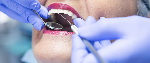 Best Emergency Dentist for Knocked-Out Tooth in Lafayette, IN